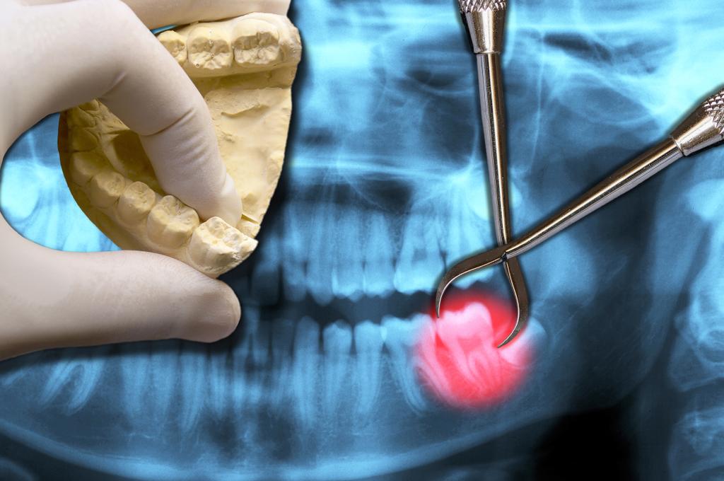 dentist hand show molar tooth
